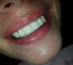 Allsmiles Dental - Cabinet stomatologic, Bucuresti