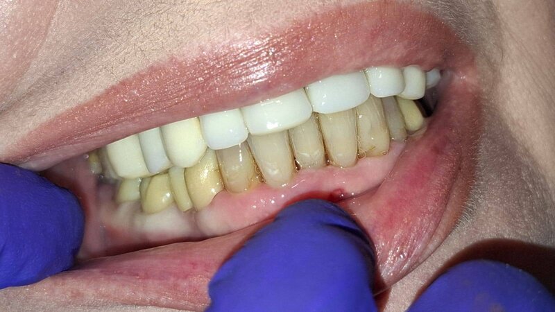 Allsmiles Dental - Cabinet stomatologic, Bucuresti