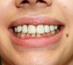 Allsmiles Dental - Cabinet stomatologic, Bucuresti