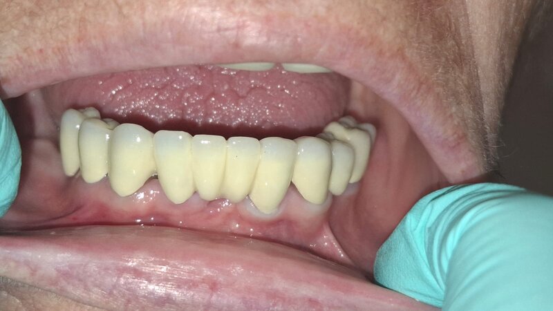 Allsmiles Dental - Cabinet stomatologic, Bucuresti